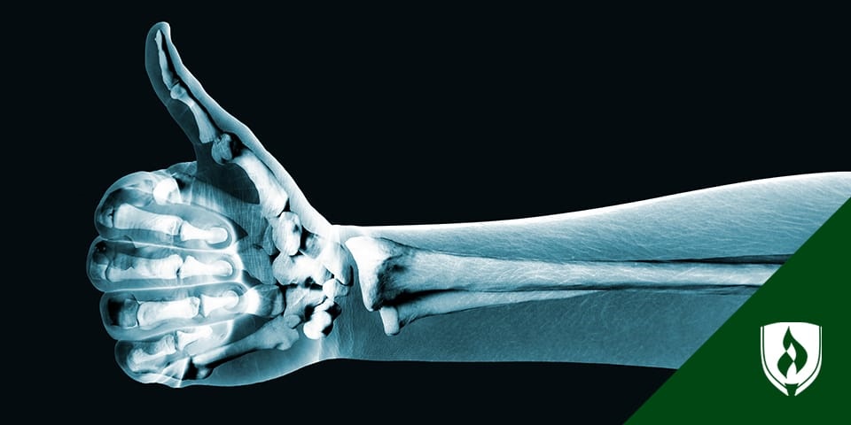 illustration of an xray thumb giving a thumbs up